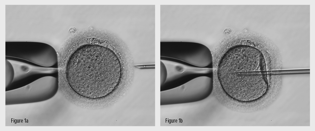 Fig. 1 - ICSI