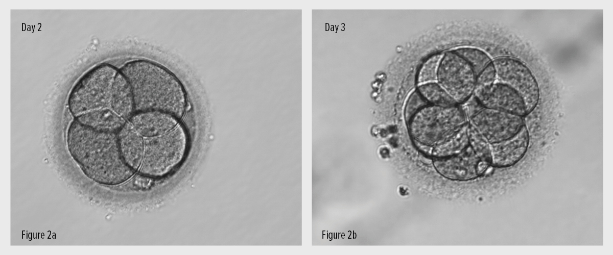 Fig. 2 - IVF - Embryo Development
