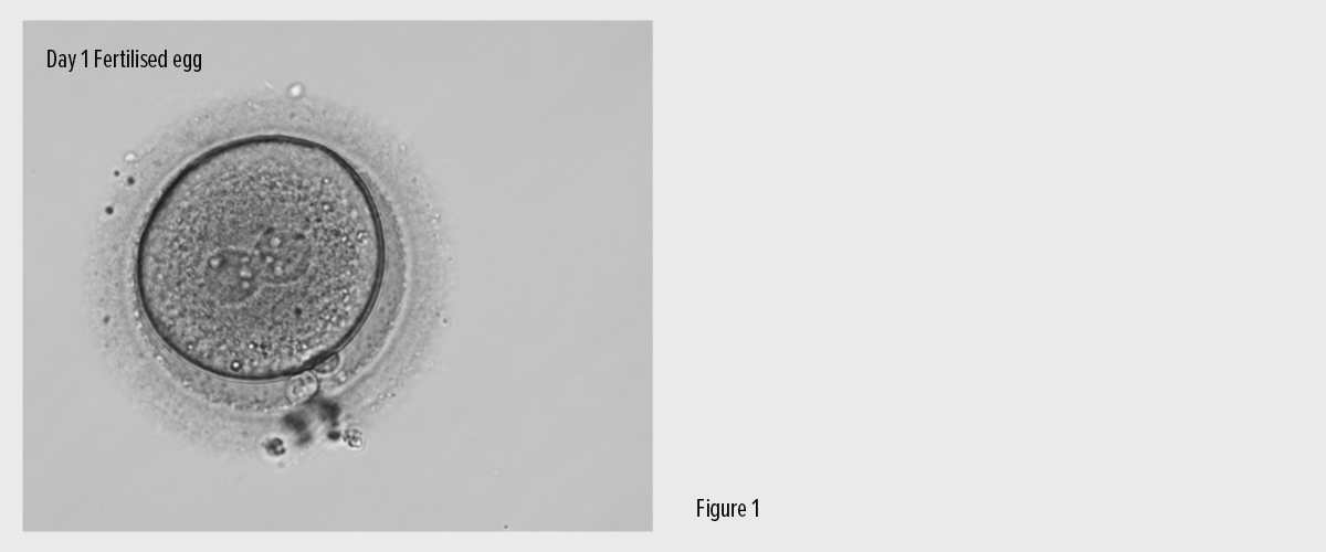 Fig. 1 - IVF - Fertilised Egg